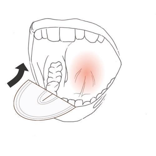 Drydent Parotid tvář vel. L 50 ks