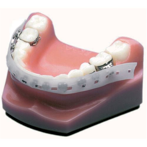 Essix chránič pro otiskování 50 ks