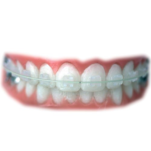 Tooth Col. Archw. - NiTi Up .019x.025 - doprodej