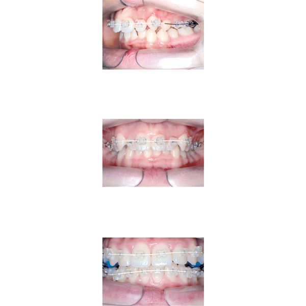 Euroform+ Cosmetic Nerez D kulaté .014 10 ks