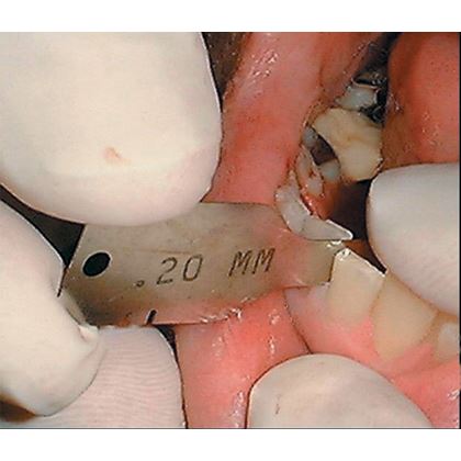 Interproximální měrky set 6 ks