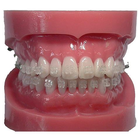 Purity MBT .022 H  4/5 L/P