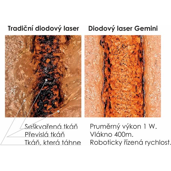 Gemini laser špičky iniciované 5mm - 25ks