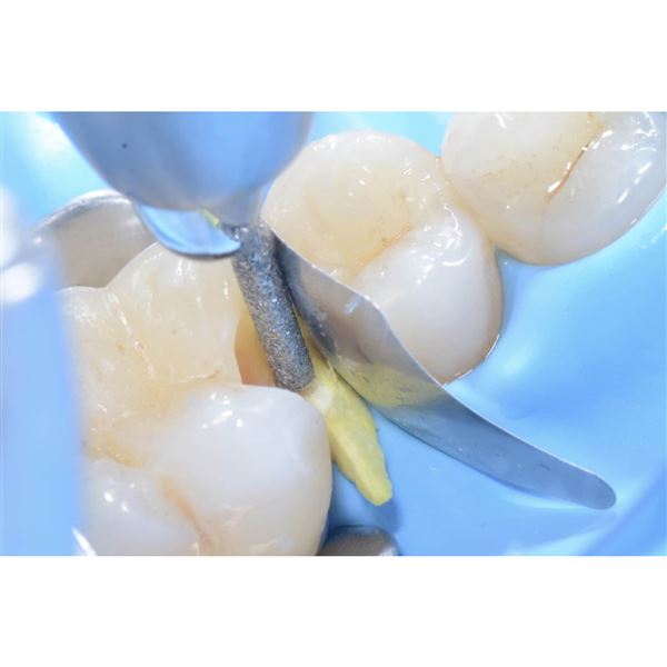 PolydentiaPRO Interproximal matrice 0,05mm, 100Pcs.