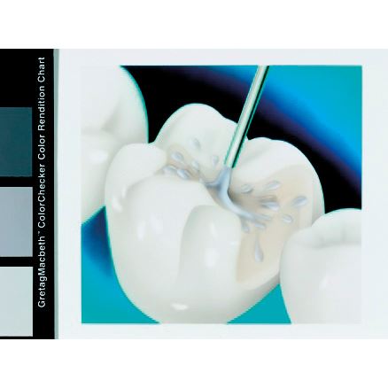 One-Step Plus 6 ml