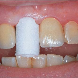 Comprecap Anatomic č.5 (L) 60 ks