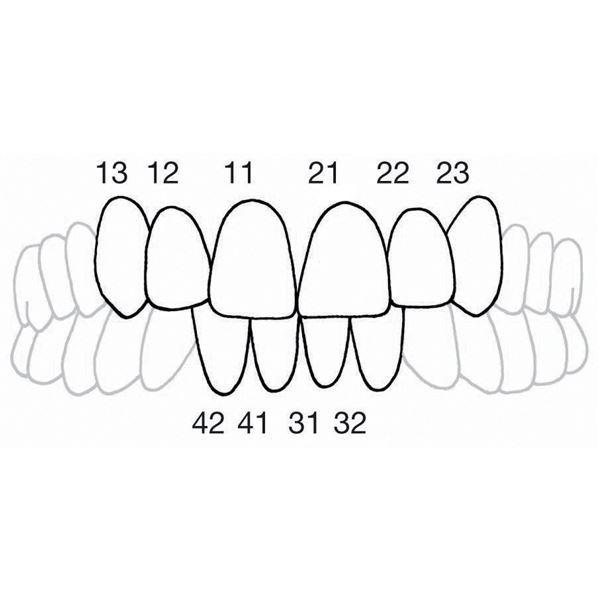 CoForm náhr. 8 ks 11M