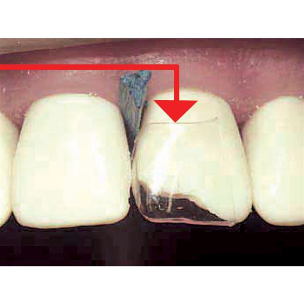 CoForm sortiment 64 ks