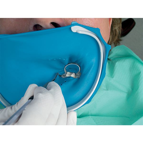 OptiDam Anterior intro kit