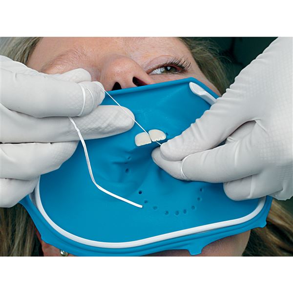 OptiDam Anterior intro kit