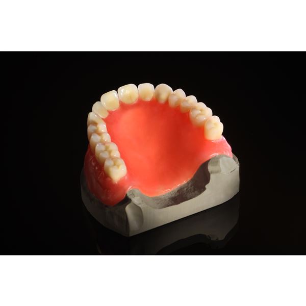 Fast Splint mřížka růžová 80 x 53 mm - 2 ks