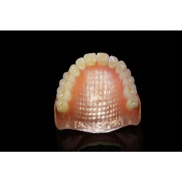 Fast Splint mřížka růžová 80 x 53 mm - 2 ks