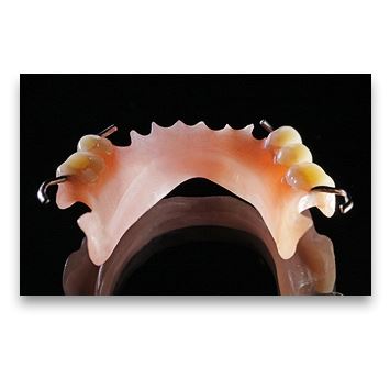 Fast Splint mřížka růžová 80 x 53 mm - 2 ks