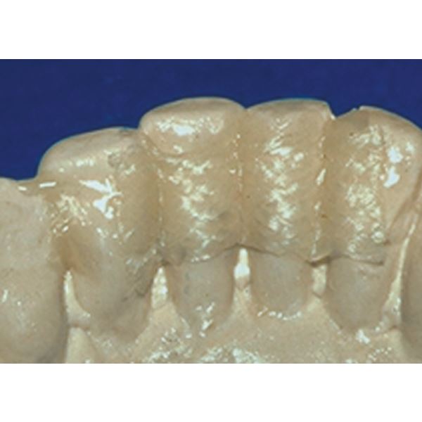 Ribbond THM Starter Kit sada HUFA