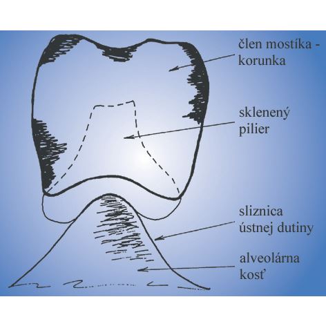 ZX-27 Řezací disk, 1ks