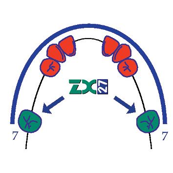 ZX-27 Kleština typ S