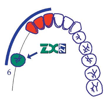 ZX-27 Instrumentárium