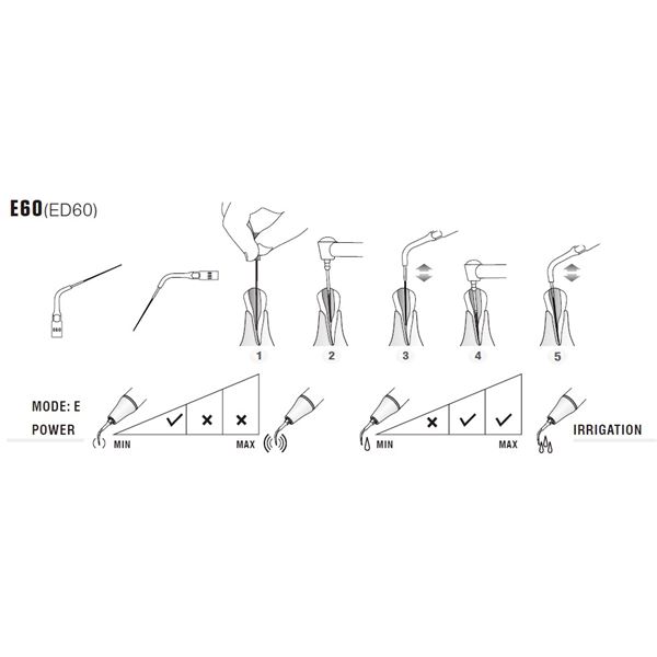 Woodpecker DTE hrot Endo ED60