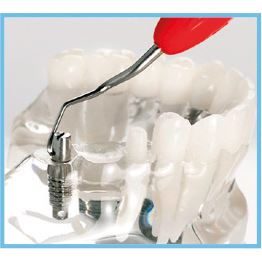 LM kyreta mini Implant Universal ErgoMix