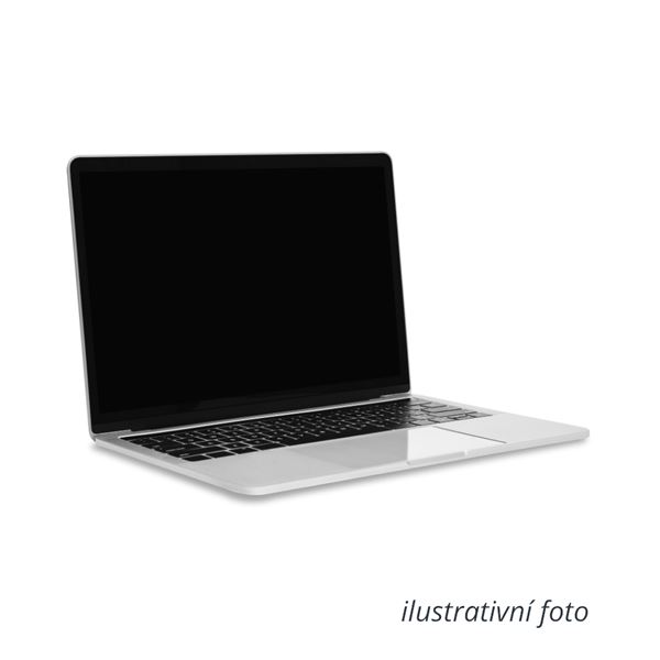 AoralScan notebook 4070 dotykový displej
