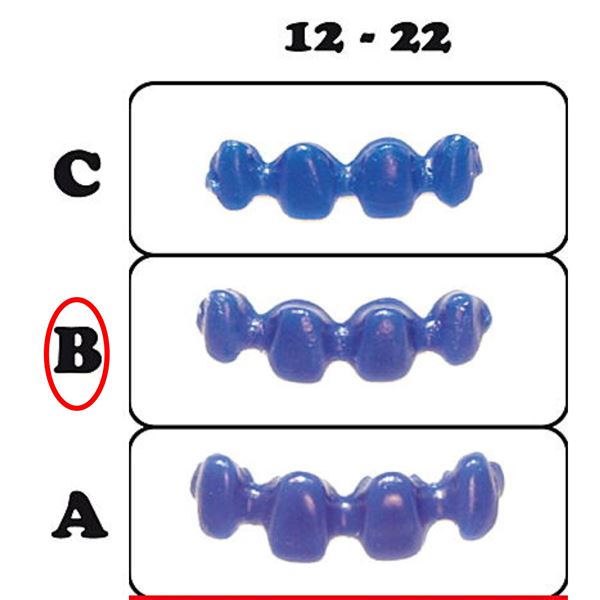 Kovokeram.bloky 12.81 12-22 B