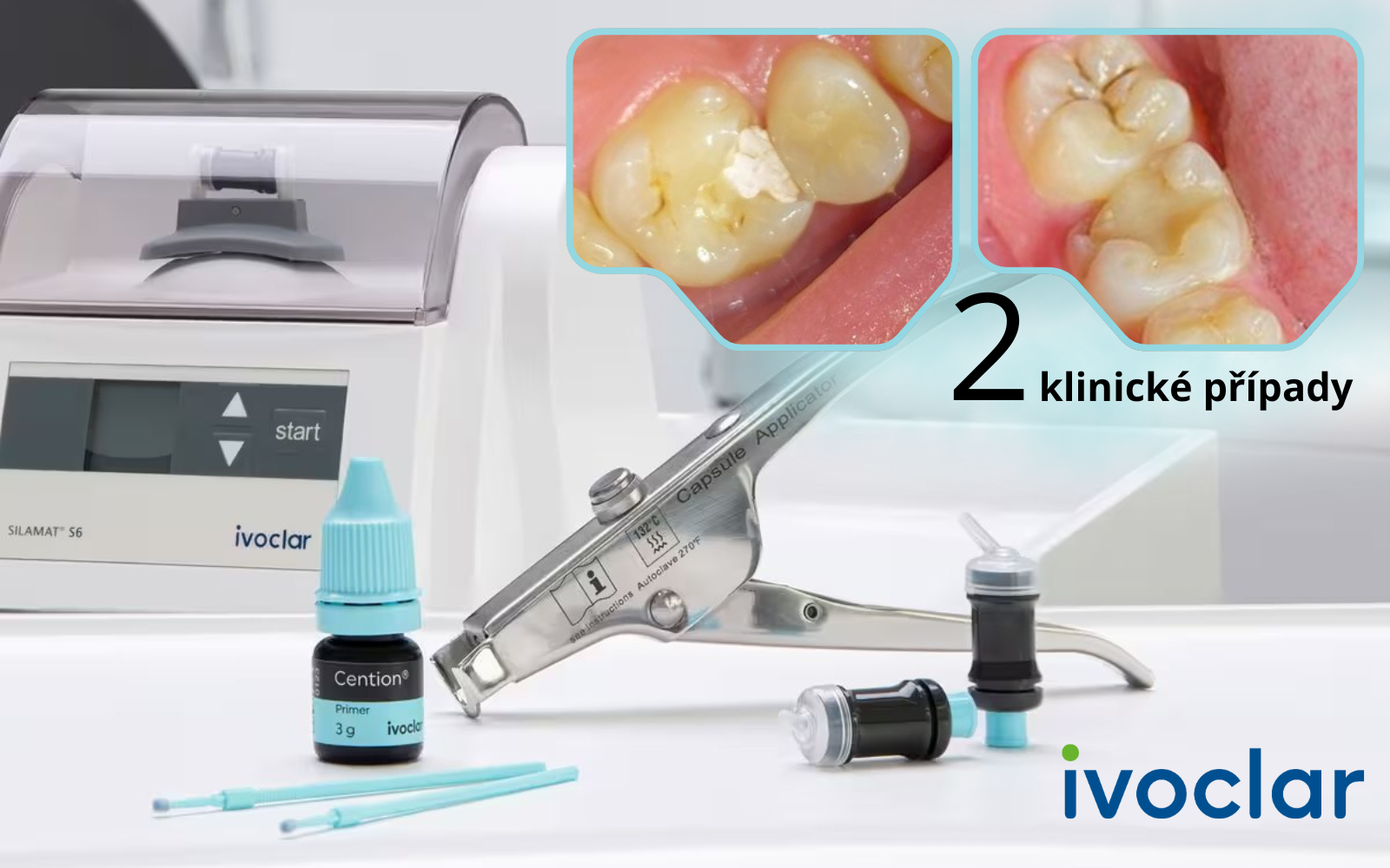 Když rozhoduje čas na křesle: distální výplň u mladého pacienta