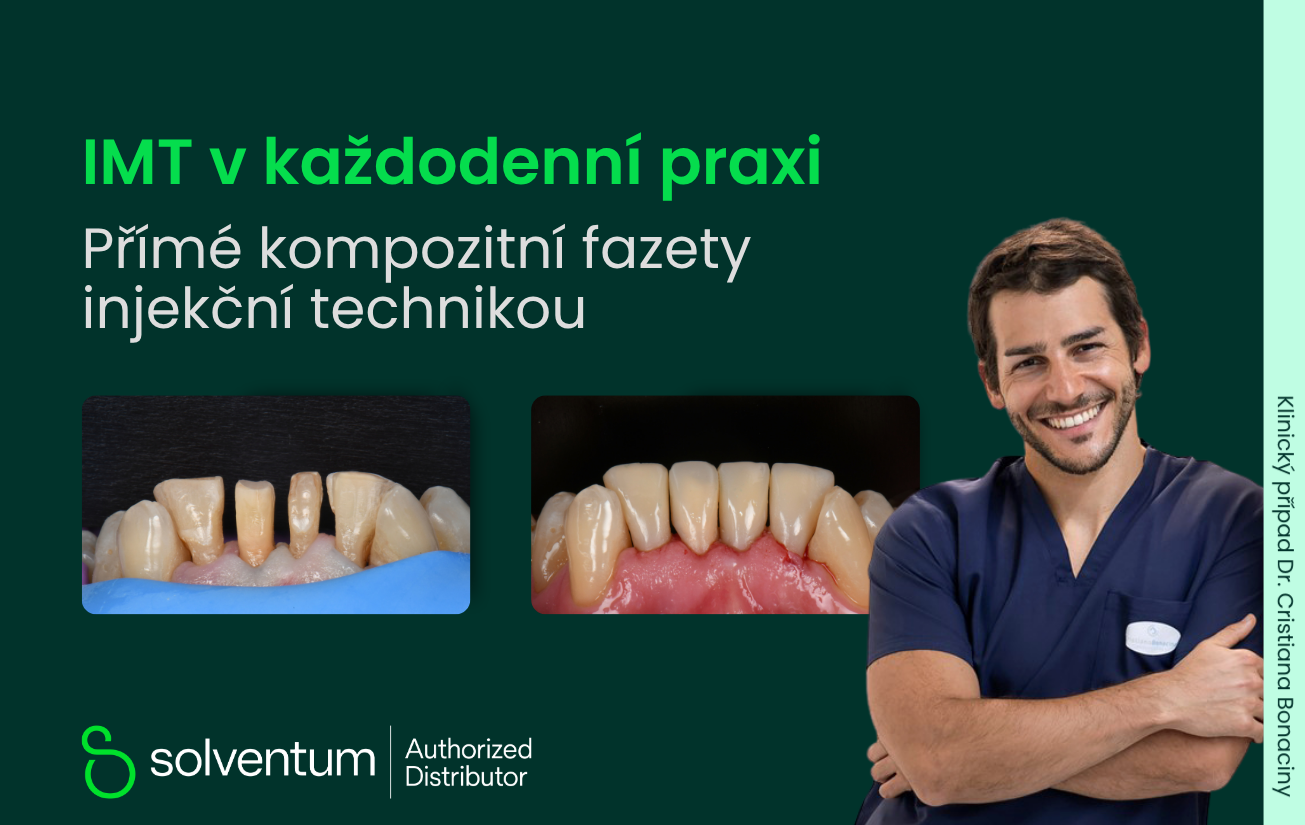 IMT - Přímé kompozitní fazety injekční technikou