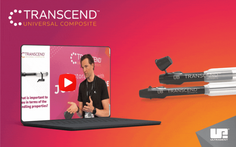 Myslím, že estetický výsledek i leštitelnost jsou opravdu, opravdu velmi dobré.